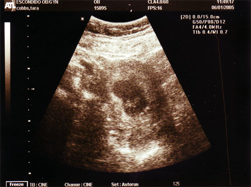 The view from the belly